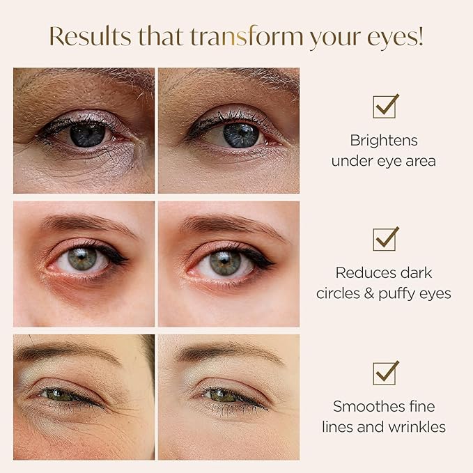 PLANTIFIQUE Gold Under Eye Patches for Puffy Eyes and Dark Circles 5 Pairs Under Eye Masks for Dark Circles and Puffiness Eye Gels with Collagen & Caffeine Eye Patches Gold Eye Mask Skincare-VivaGrace Women