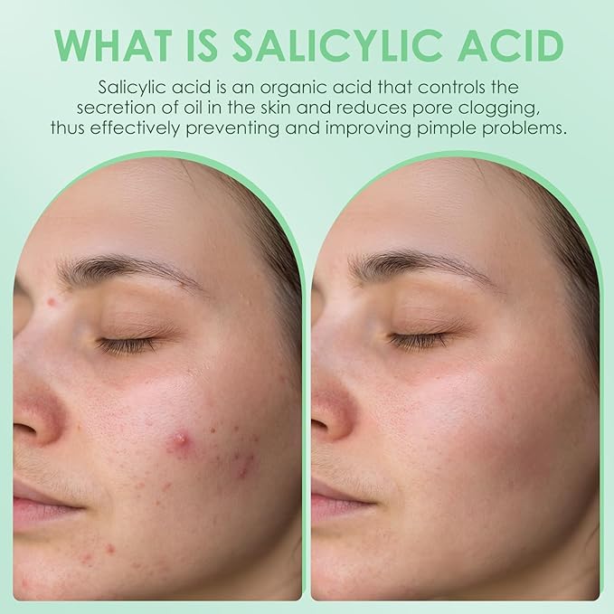 AUSLKA Salicylic Acid Oil Balancing Spray with 2% Salicylic Acid Regulates Skin Balance for Pimple and Oily Skin, Fruit Acid Spray for Face & Body (3.4 Fl Oz)-VivaGrace Women