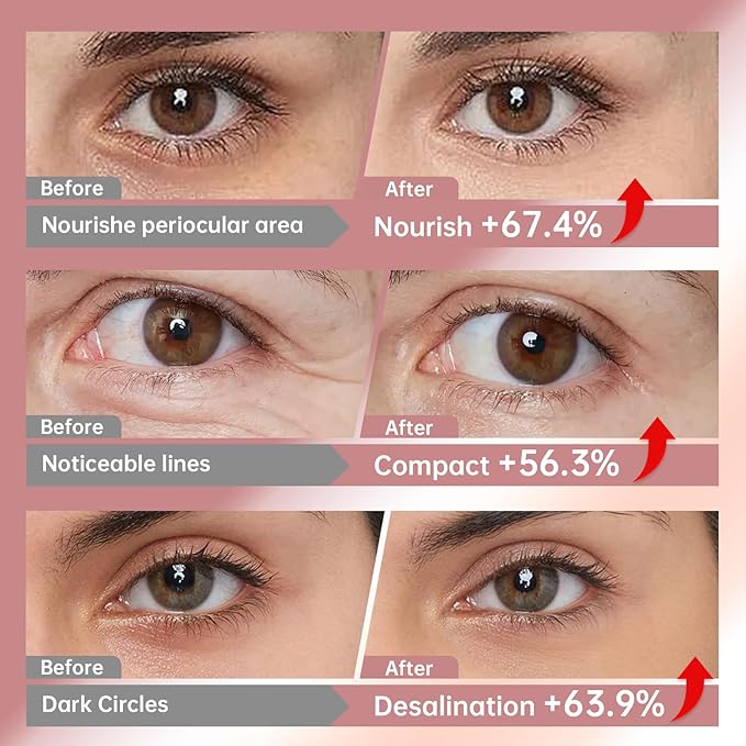 Novoy 15 Pairs Bio-Collagen Real Deep Eye Patches - 6-in-1 Retinol Overnight Eye Patches for Dark Circles, Puffiness & Wrinkles | 2% Caffeine+Hyaluronic+Niacinamide, Korean Popular Eye Mask - ROSE-VivaGrace Women