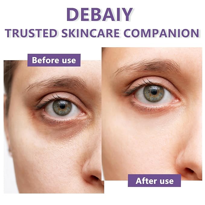 3 Pack Eye Cream Hydrating & Repairing with Hyaluronic Acid & Peptides - Moisturizes, Smooths Fine Lines, Enhances Elasticity (Each 0.529oz | 15g)-VivaGrace Women