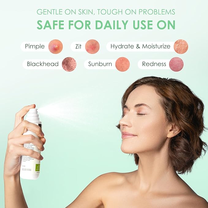 AUSLKA Salicylic Acid Oil Balancing Spray with 2% Salicylic Acid Regulates Skin Balance for Pimple and Oily Skin, Fruit Acid Spray for Face & Body (3.4 Fl Oz)-VivaGrace Women