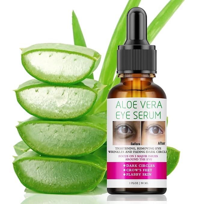 Aloe Vera Eye Serum Dark Circles Under Eye Treatment for Women to Reduce Appearance of Puffy Eyes Eye Bags Fine Lines and Wrinkles for All Skin Types, Beauty Skin Care Gift-VivaGrace Women