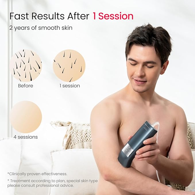 IPL Laser Hair Removal for Men, Dual Lights 100W, 35°F Sapphire Ice-Cooling, Quadruple-Pulse PHR Mode for Stubborn Hair, at Home Hair Removal Device for Armpits, Chest and Leg-VivaGrace Women