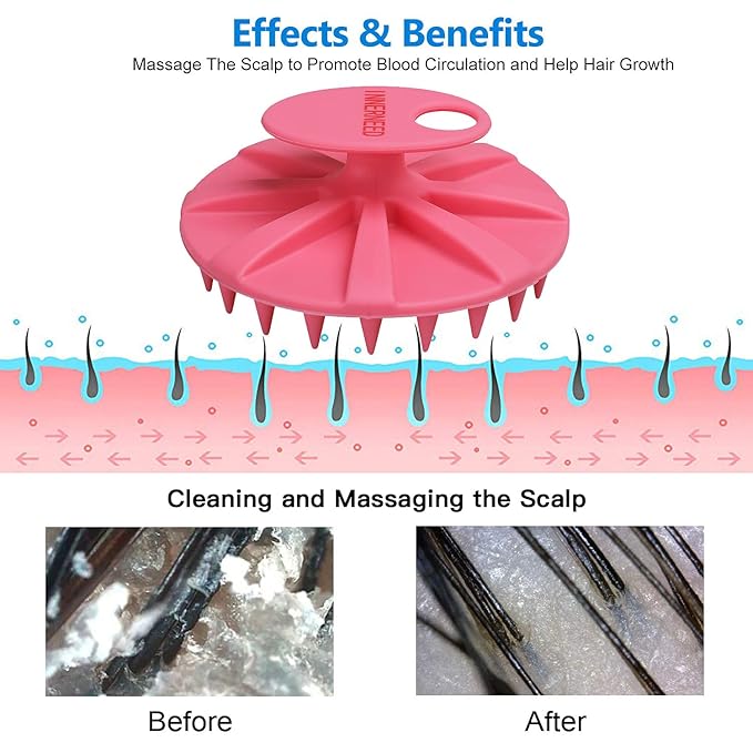 INNERNEED Scalp Massager Shampoo Brush, Wet & Dry Manual Scalp Care Head Scrubber Hair Washing, Soft Silicone Bristles, for Hair Growth, Dandruff Removal, Comfortable for All Hair Types (Pink)-VivaGrace Women