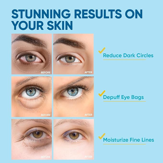 Under Eye Patches for Anti-Aging: 30 Pairs Retinol Collagen Gel Eye Pads - Reduces Wrinkles, Dark Circles, Eye Bags & Puffiness, Fine Lines Smoothing Treatment & Hydrating Eye Mask for Women-VivaGrace Women