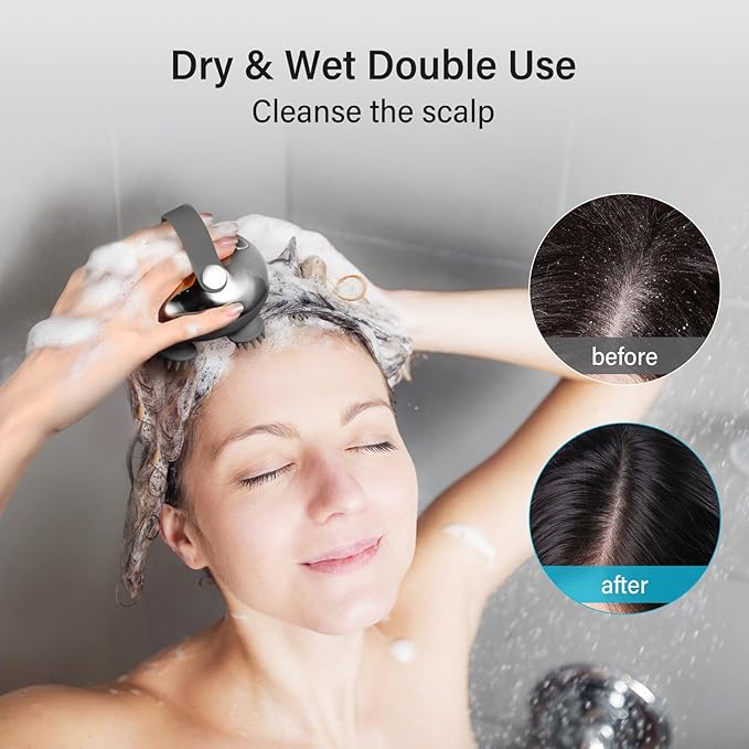 arboleaf Scalp Massager Rechargeable Head Massager Scalp Stress Relax, Waterproof Handheld Hair Scratcher with 8 Removable Massage Claws, Gift for Dad Mom-VivaGrace Women