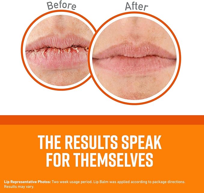 O'Keeffe's Unscented Lip Repair Lip Balm for Dry, Cracked Lips, Stick, (Pack of 3)-VivaGrace Women