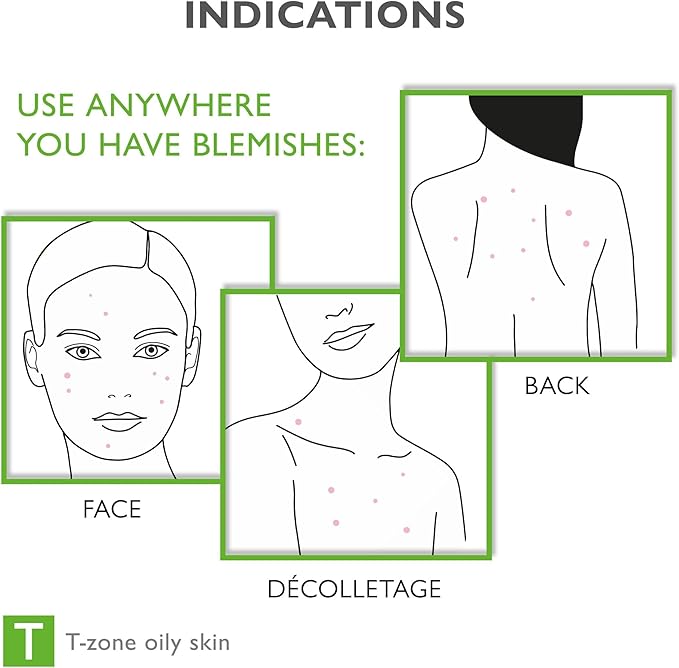 Face & Body Breakout Solution - 3% Mandelic Acid Helps Clarify Blemish & Acne Prone Skin, Face, Back & Chest Pimples Exfoliating & Clearing Treatment, SEBO-ALMOND-CLARIS, 6.42 fl oz-VivaGrace Women