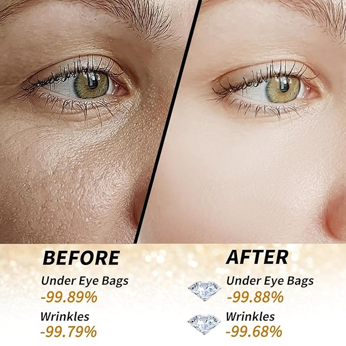 24k Gold Under Eye Patches - 60 Pcs Eye Mask Pure Gold Anti-Aging Collagen Hyaluronic Acid Under Eye Mask for Dark Circles, Puffiness & Wrinkles Refresh Your Skin-VivaGrace Women