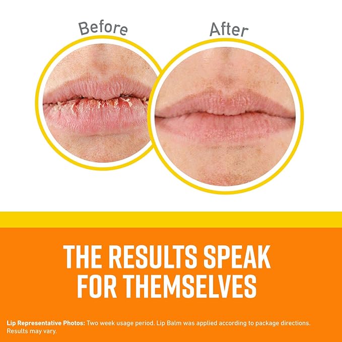 O'Keeffe's Lip Repair SPF 35 Lip Balm Stick, (Pack of 2)-VivaGrace Women