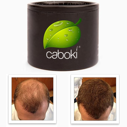 Thinning Hair Solution - All-Natural, Plant-Based Fibers For Fuller, Thicker Appearance. Instantly Covers Bald Spots. Auburn (red/ginger hair). Trial Size, 10-Day Supply-VivaGrace Women