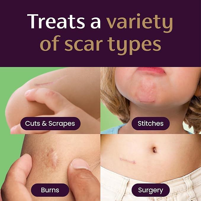 Mederma Scar Gel for Kids - Reduces Appearance of Old & New Scars from Cuts, Burns, Surgery, Insect Bites & Scrapes, Grape Scented, Goes on Purple & Rubs in Clear, Ages 2+, 0.70 Oz-VivaGrace Women