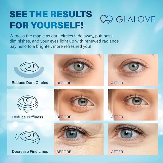 Under Eye Patches for Dark Circles: 60 Count Retinol Collagen Eye Gels Pads - Reduce Wrinkles, Puffy Eyes, Eye Bags - Skin Treatment Mask for Anti Aging & Face Moisturizer 1-VivaGrace Women