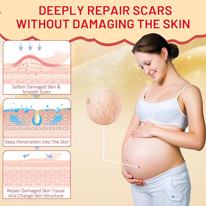 Stretch Mark Oil for Pregnancy, Skincare Body Oil for Scars and Stretchmarks, Pregnancy Oils for Stretch Marks Pre and Postpartum Natural Skincare Massage Oil, Skin Regenerate Oil, 4.2 fl.oz-VivaGrace Women