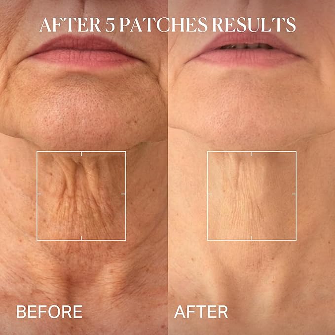 depology Tightening and Lifting Neck Wrinkle Patches with Cream, PDRN Deep Collagen Neck Mask, Firming Patch with PDRN、Collagen and Niacinamide Cream-VivaGrace Women