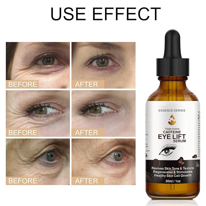 2 PCS Caffeine Eye Serum - Eye Cream for Dark Circles and Puffiness, with EGCG, Ascorbic Acid, Collagen, Caffeine Eye Lift Serum Reduces Under Eye Bags Wrinkles and Fine Lines- 2 oz/60 ml-VivaGrace Women