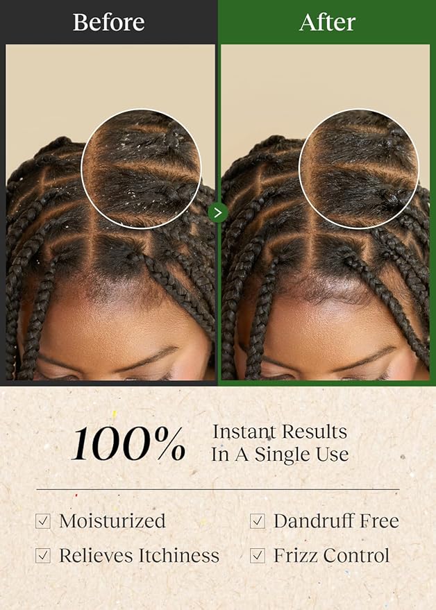 Braid Rev Scalp Cleansing Toner for Braiding Hair, Apple Cider Vinegar Scalp Treatment Exfoliator, No-Rinse, Scalp Treatment for Dry & Itchy, Moisturizing Braid, Detoxify, 6.76 Fl Oz-VivaGrace Women