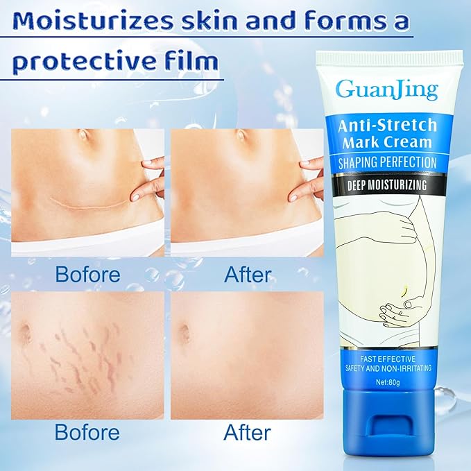 Stretch Mark Cream Stretch Mark Oil for Pregnancy, Stretch Mark Removal Belly Butter for Pregnant Women To Prevent And Repair Maternity Stretch Marks Scar Cream 2.82 Oz Skincare Body Oil 4.2 Fl.oz-VivaGrace Women