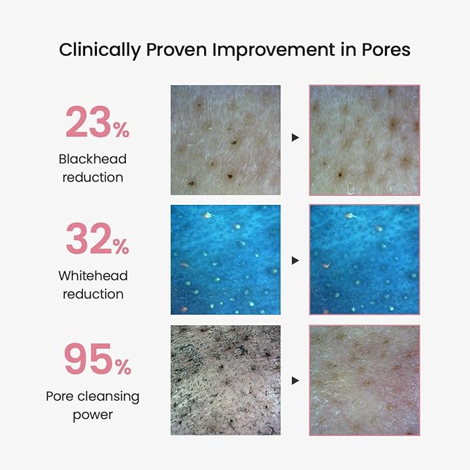 BIODANCE Collagen Cleansing Oil, Facial Oil Cleanser, Gentle Makeup Remover without Clogging Pores, Removes Bleackhed and Whitehead for Sensitive Skin, Oily Skin, Korean Skincareㅣ6.76 fl. oz. (200 ml)-VivaGrace Women