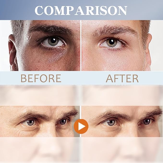 Men's Restoring Eye Cream Under Eye Cream for Dark Circles & Puffiness, Delay Aging Process of Eye Skin, Hydrating & Moisturizing, Reduces Puffiness, and Fine Lines-VivaGrace Women