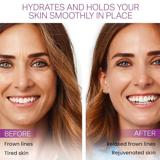 Furlesse Elevens Wrinkle Patches, Overnight Wrinkle Patches for Frown Lines, Non-Invasive Anti-Wrinkle Patches, Anti-Aging Skincare, 30 Patches, 30-Day Use-VivaGrace Women