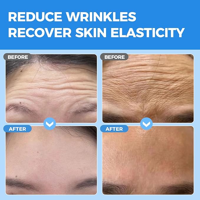 Okela Forehead Wrinkle Patches Overnight 20 pcs with Collagen, Anti Wrinkle Patches, Forehead Wrinkles Beauty Treatment-VivaGrace Women