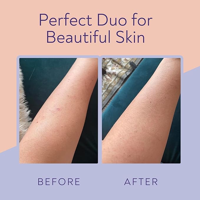 KP Bump Eraser Body Scrub & Keratosis Pilaris Lotion Bundle Set – Strawberry Legs Treatment for Women - Exfoliates & Deeply Hydrates for Smoother Healthy-Looking Skin-VivaGrace Women