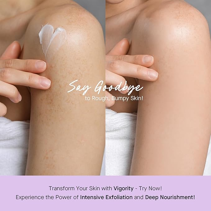 Vigority Keratosis Pilaris Treatment Cream with Lactic Acid – KP Body Bump Exfoliating Moisturizer for Rough, Bumpy, Dry & Flakey Skin, Strawberry Legs – 5.1 Oz-VivaGrace Women