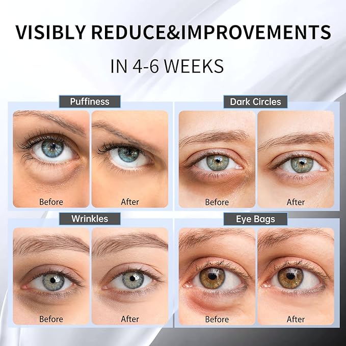 Advanced Snail Hydrogel Eye Patch 60 Patches, Gel Serum Mask, Undereye Treament, Fine Lined, Puffy Eyes, Refresh, Hydrate, Paraben free, Phthalates free, Skincare-VivaGrace Women