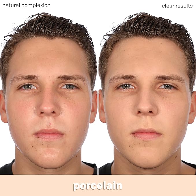 Almay Clear Complexion Acne Foundation Makeup with Salicylic Acid - Lightweight, Medium Coverage, Hypoallergenic, Fragrance-Free, for Sensitive Skin, 099 Porcelain, 1 fl oz.-VivaGrace Women