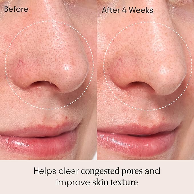 ALPYN Clarifying Facial Oil with Retinol & Pink Algae | Clear Congestion, Smooth Fine Lines, Improve Texture & Glow | 1 Fl Oz / 30 ml-VivaGrace Women