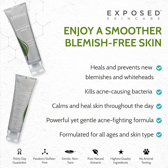 Exposed Skin Care Acne Treatment Serum Step 3 – Quickly Reduces Pimple Size and Redness - 12 Hour Spot Treatment - 3.5% Benzoyl Peroxide, Natural Green Tea & Tea Tree Oil-VivaGrace Women