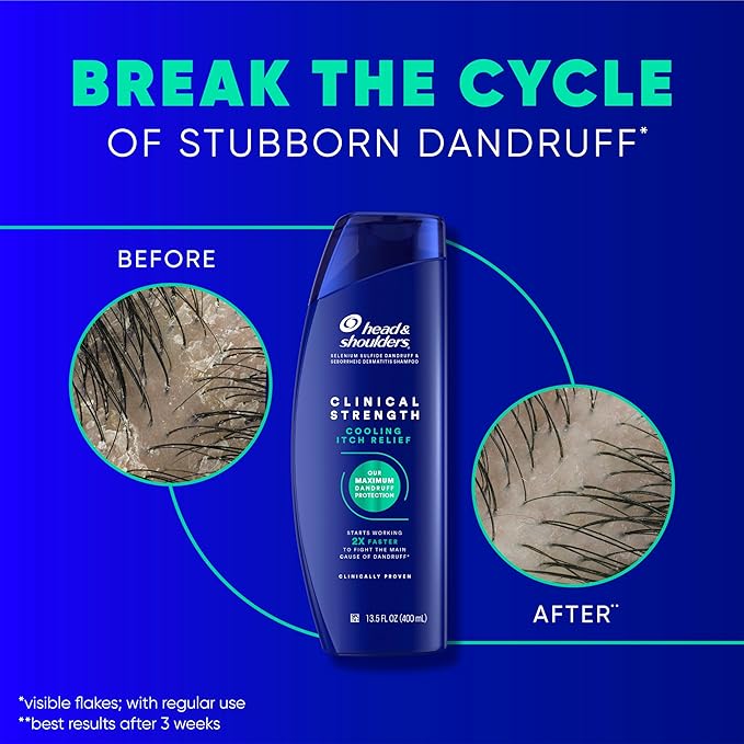 Head & Shoulders Clinical Strength Dandruff Shampoo, Selenium Sulfide Dandruff Defense, Intensive Itch Relief, Seborrheic Dermatitis Relief, Cooling Menthol, 13.5 Fl Oz Each, 2 Pack-VivaGrace Women