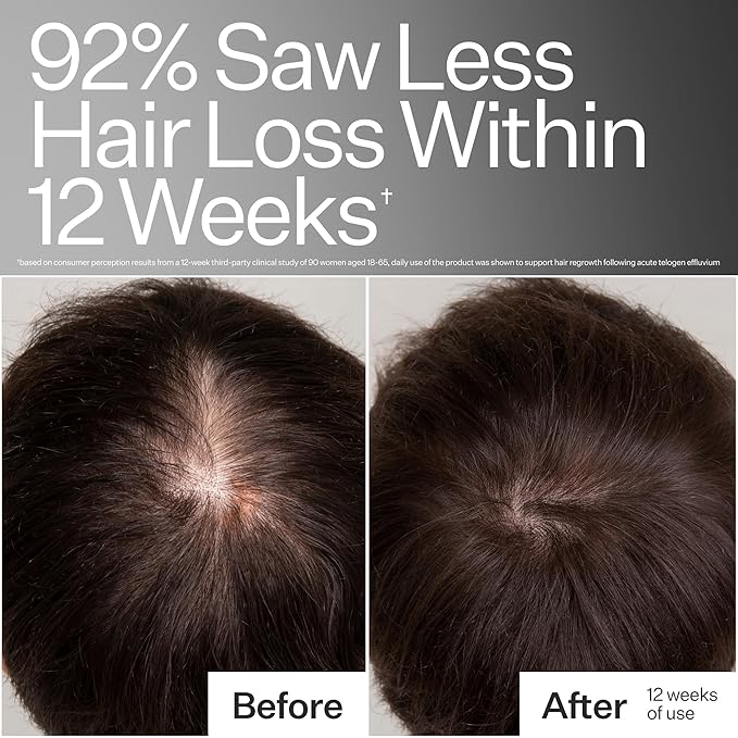 Act+Acre Cold Processed 3% Stem Cell Peptide Treatment | Boosts Hair Density | Grape Stem Cells, Peptides + Caffeine | Vegan, Fragrance-Free | 3 Fl Oz-VivaGrace Women