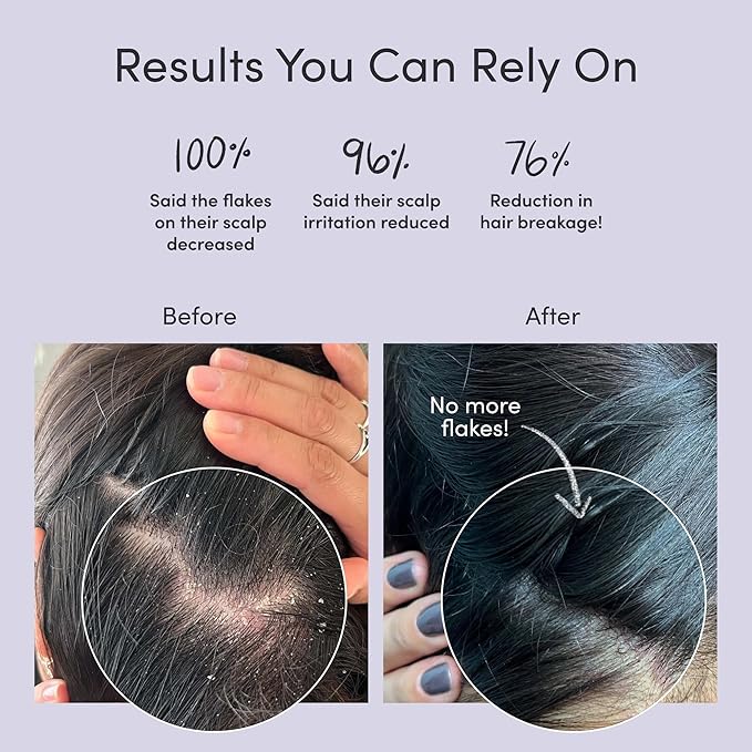 Jupiter Oil Control Exfoliation Set, Anti-Dandruff Shampoo, Conditioner, Restoring Serum, Purifying Mask, & Daily Scalp Essential, Physician-Formulated for Flaky, Itchy, Oily, & Dry Scalp-VivaGrace Women