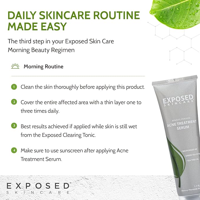 Exposed Skin Care Acne Treatment Serum Step 3 – Quickly Reduces Pimple Size and Redness - 12 Hour Spot Treatment - 3.5% Benzoyl Peroxide, Natural Green Tea & Tea Tree Oil-VivaGrace Women