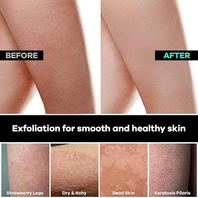 Dermasuri Deep Exfoliating Glove for Shower - Scrubbing Mitt Body Scrubber Gloves Skin Exfoliator & Eliminates Dead Skin - Keratosis Pilaris Scrub Spray Tan Remover - Korean Skincare for Body (2 Pack)-VivaGrace Women