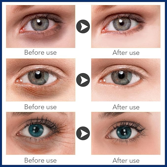Under Eye Cream for Dark Circles and Fine Lines, Repair Eye Cream for Lifting Firming and Anti-Wrinkle, Anti Age Eye Care Product-VivaGrace Women
