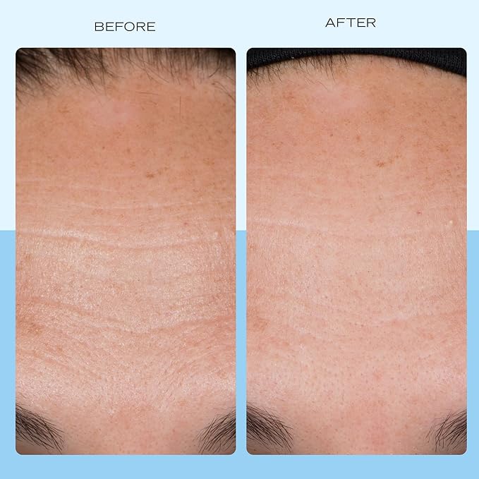 First Aid Beauty Firming Collagen Cream with Collagen, Peptides and Niacinamide – Day + Night Anti-Aging Face Moisturizer – 1.7 fl oz-VivaGrace Women