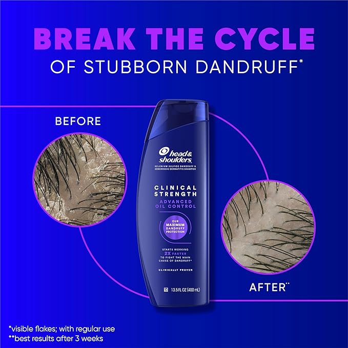 Head & Shoulders Clinical Dandruff Shampoo Twin Pack, Prescription Strength, Oil & Flake Control, Seborrheic Dermatitis Relief, Citrus, 13.5 Fl Oz Each (Set of 2)-VivaGrace Women