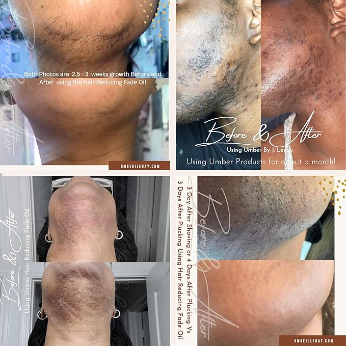 Hair Reducing Fade Oil – Regular Strength (Not sensitive skin), Minimizes Hair Growth for Face & Body – For Women & Men – 15ml Serum-VivaGrace Women