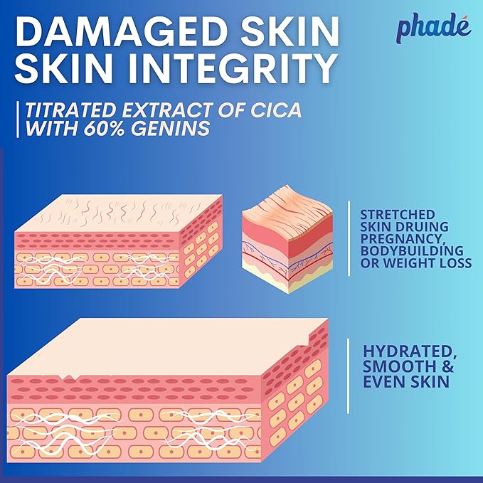 Phade Stretch Mark Cream with CICA - 200ml | Pregnancy, Scars, Uneven Skin Tone, Aging | Dermatologist Tested, Clinically Proven Formula for Stretch Marks, Hydration, and Skin Repair-VivaGrace Women