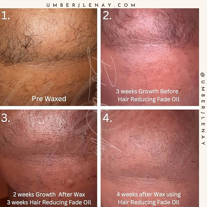 Hair Reducing Fade Oil – Regular Strength (Not sensitive skin), Minimizes Hair Growth for Face & Body – For Women & Men – 15ml Serum-VivaGrace Women