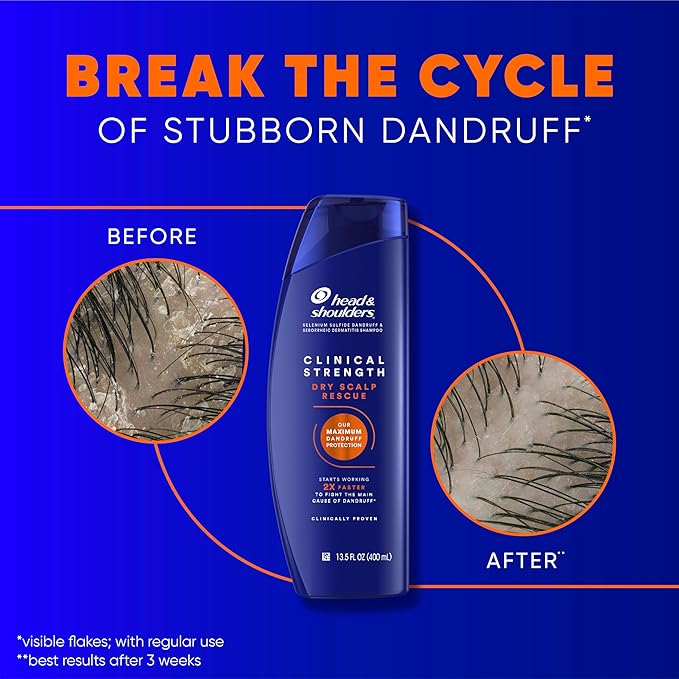 Head & Shoulders Clinical Dandruff Defense + Dry Scalp Rescue Shampoo 13.5 oz Twin Pack-VivaGrace Women