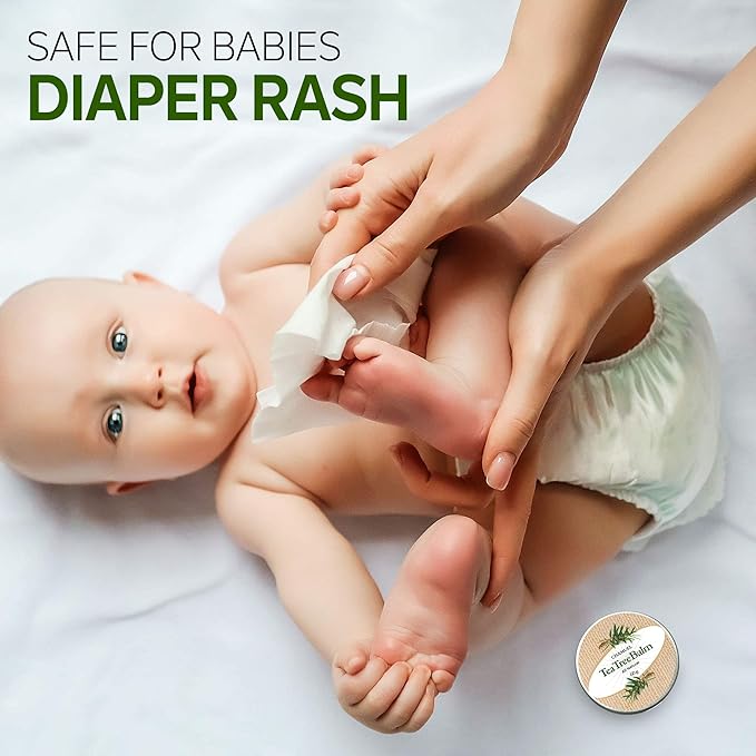 Tea Tree Oil Balm -100% All Natural | Great Cream for Soothing Irritations like Rashes, Insect Bites, Folliculitis, Acne, Itches, Dry Heels, Cuticles, Saddle Sores and more!-VivaGrace Women