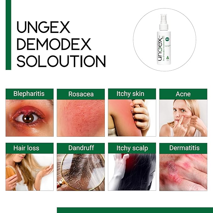 Basic Kit-i | Demodex Solution For Acne Rosacea, Itchiness, Redness | Ungex-VivaGrace Women