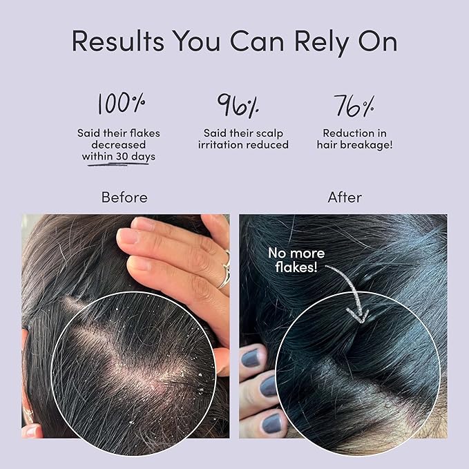 Jupiter Oil Control & Exfoliation Bundle, Anti-Dandruff Shampoo, Conditioner, Restoring Serum, & Purifying Mask for Women & Men, Dermatologist-Formulated for Flaky, Itchy, Oily, & Dry Scalp-VivaGrace Women