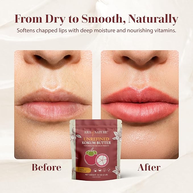 era of nature Kokum Butter Raw - 32 oz (2lb) – Natural Butter for Body Butters, Lotion Bars, Lip Balm, Soap Making – Blends Well with Shea or Cocoa Butter – For Stretch Marks, Scars, Pregnancy Care-VivaGrace Women