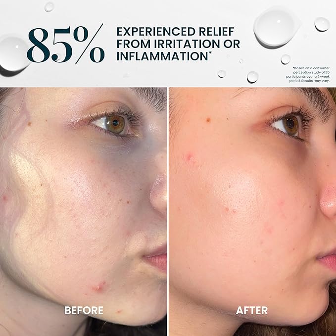 FlutterHabit Hypochlorous Acid Spray, Face Mist for Acne Prone Skin, HOCl Formula to Soothe Irritation, Refresh Complexion, Repair Damage, Balance Oil, Calm Redness, Restore Clarity (125mL)-VivaGrace Women