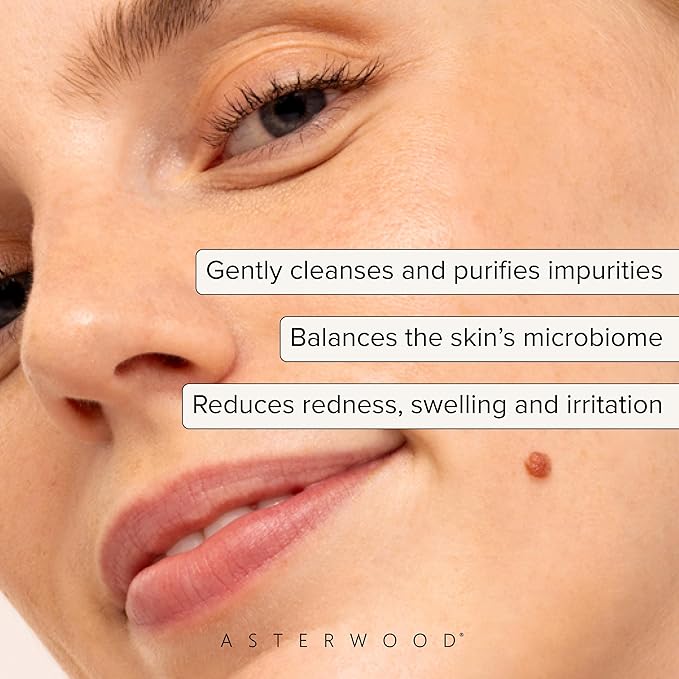 Asterwood Hypochlorous Acid Spray for Face - Targets Acne, Redness, Irritation - Multi-Purpose Skin Repair - Antibacterial, Antimicrobial - After Gym/Post-Workout Facial Mist - 4 Fl Oz-VivaGrace Women